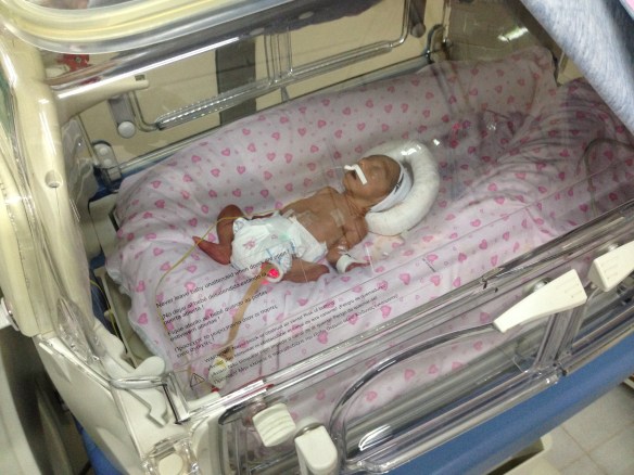 Bebé nacido prematuramente